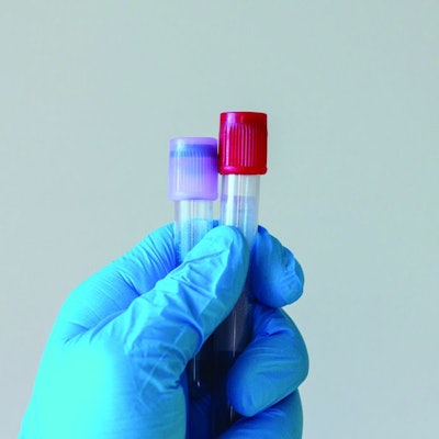 Gloved-hand-holding-test-tube.jpg