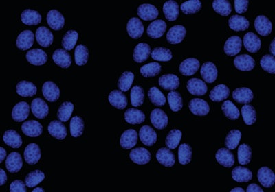 Editing a number of areas of chicken DNA has proved successful in blocking avian influenza infection in vitro.
