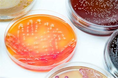 Bacterial Culture Growth